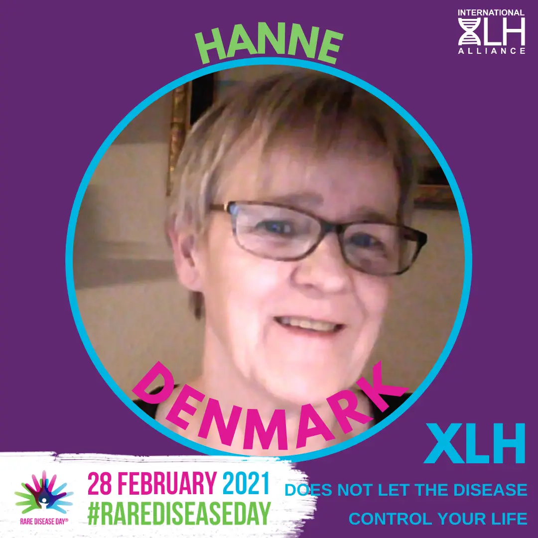 Hanne-rare