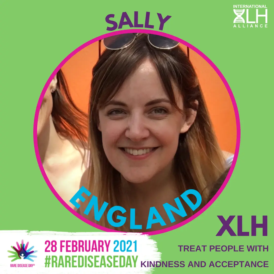 Sally-rdd