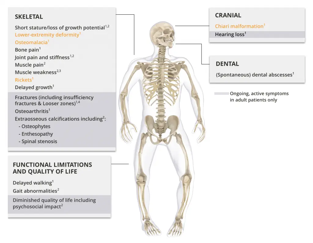 adult manifestations